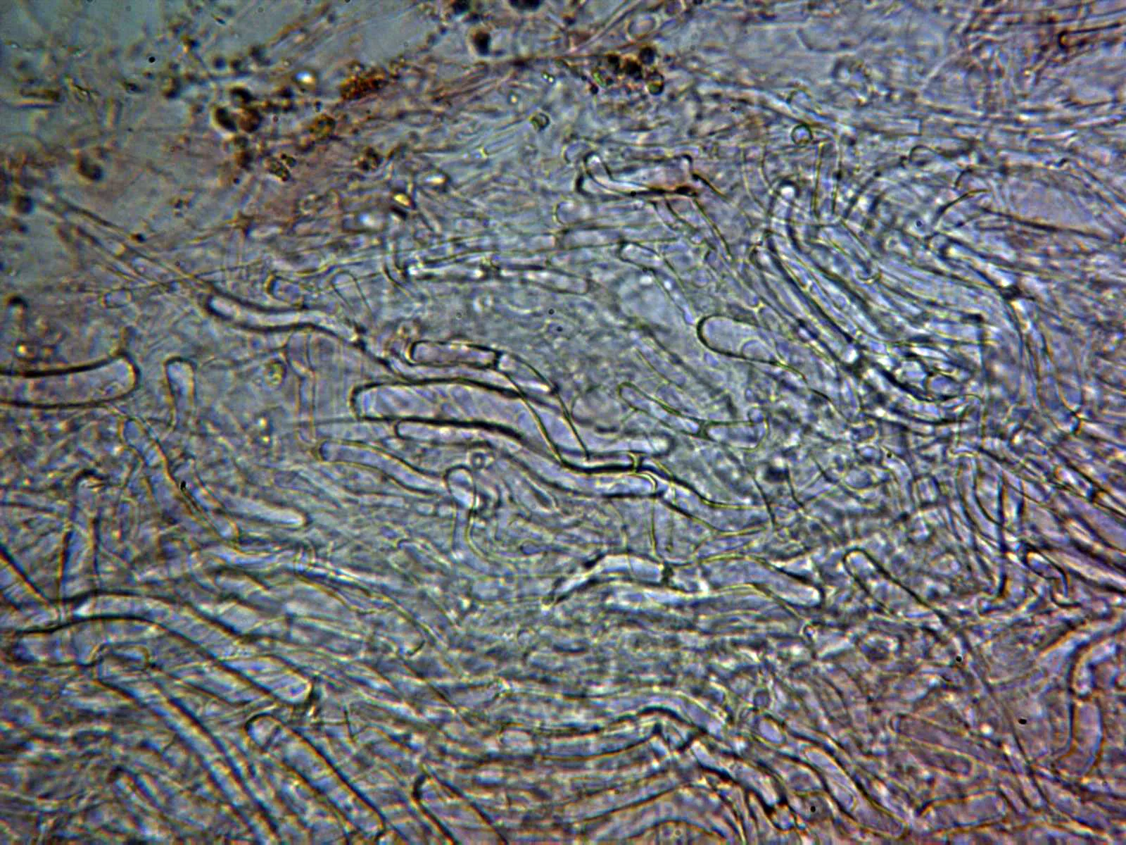 Microscopía de Lepista sordida - 12 - Pileipellis x 400